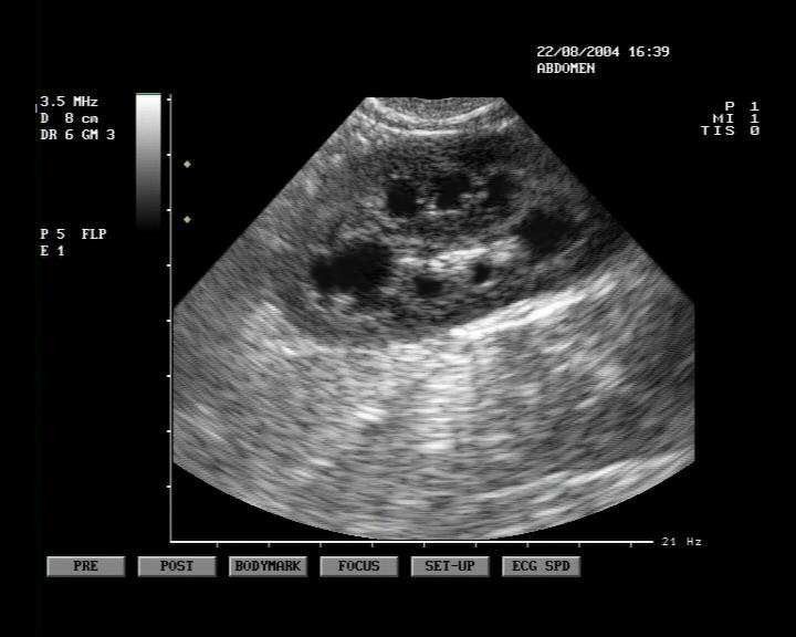 Ultrasound Image